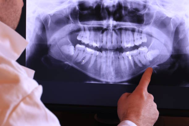 Best Pediatric Emergency Dentist in Farwell, TX
