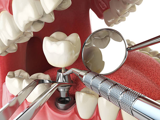 Best Emergency Dental Surgery in Farwell, TX
